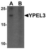 YPEL3 Antibody in Western Blot (WB)