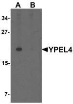 YPEL4 Antibody in Western Blot (WB)