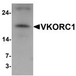 VKORC1 Antibody in Western Blot (WB)