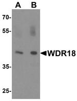 WDR18 Antibody in Western Blot (WB)