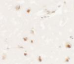 SHANK3 Antibody in Immunohistochemistry (IHC)