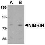 NBS1 Antibody in Western Blot (WB)