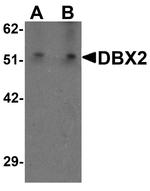 DBX2 Antibody in Western Blot (WB)