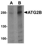 ATG2B Antibody in Western Blot (WB)