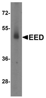 EED Antibody in Western Blot (WB)