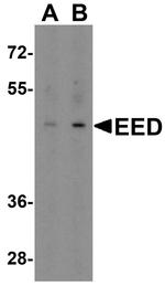 EED Antibody in Western Blot (WB)