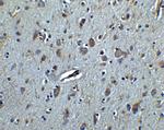 TET3 Antibody in Immunohistochemistry (IHC)