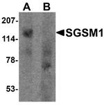 SGSM1 Antibody in Western Blot (WB)