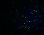 PLAGL2 Antibody in Immunohistochemistry (IHC)