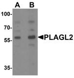 PLAGL2 Antibody in Western Blot (WB)