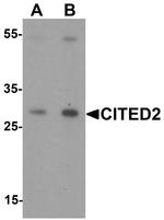 CITED2 Antibody in Western Blot (WB)