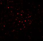 BATF Antibody in Immunohistochemistry (IHC)