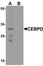 C/EBP delta Antibody in Western Blot (WB)