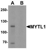 MYT1L Antibody in Western Blot (WB)