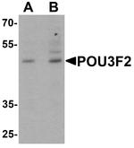 POU3F2 Antibody in Western Blot (WB)