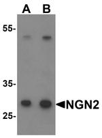 Neurogenin 2 Antibody in Western Blot (WB)