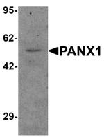 Pannexin 1 Antibody in Western Blot (WB)