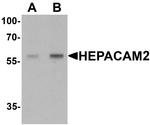 HEPACAM2 Antibody in Western Blot (WB)