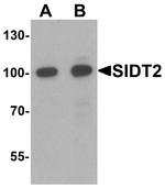 SIDT2 Antibody in Western Blot (WB)