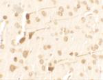 TPT1 Antibody in Immunohistochemistry (IHC)