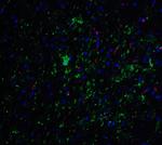 NELF Antibody in Immunohistochemistry (IHC)