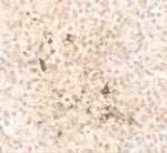 IL-15 Antibody in Immunohistochemistry (IHC)