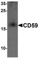 CD59 Antibody in Western Blot (WB)