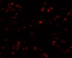 TARC Antibody in Immunohistochemistry (IHC)