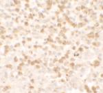 TARC Antibody in Immunohistochemistry (IHC)