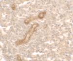 PRKCDBP Antibody in Immunohistochemistry (IHC)