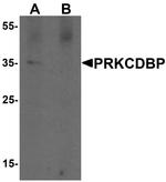 PRKCDBP Antibody in Western Blot (WB)