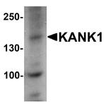 KANK1 Antibody in Western Blot (WB)