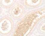 WAC Antibody in Immunohistochemistry (IHC)