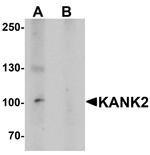 KANK2 Antibody in Western Blot (WB)