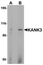 KANK3 Antibody in Western Blot (WB)