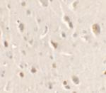 ULK1 Antibody in Immunohistochemistry (IHC)