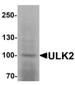 ULK2 Antibody in Western Blot (WB)