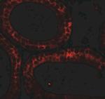 DIS3 Antibody in Immunohistochemistry (IHC)