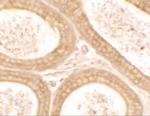 DIS3 Antibody in Immunohistochemistry (IHC)