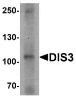 DIS3 Antibody in Western Blot (WB)