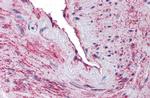 SCUBE3 Antibody in Immunohistochemistry (IHC)