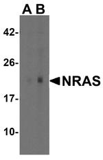 N-Ras Antibody in Western Blot (WB)