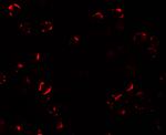 TRIM24 Antibody in Immunocytochemistry (ICC/IF)