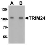 TRIM24 Antibody in Western Blot (WB)