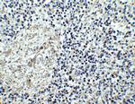 IL17RA Antibody in Immunohistochemistry (IHC)