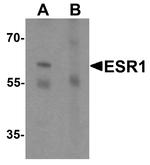 Estrogen Receptor alpha Antibody in Western Blot (WB)