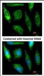 ALDH1A1 Antibody in Immunocytochemistry (ICC/IF)