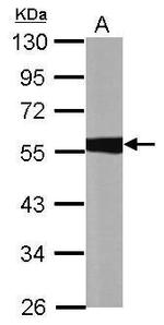 ALDH1A1 Antibody in Western Blot (WB)