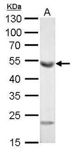 ALDH1A1 Antibody in Western Blot (WB)