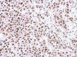 Phospho-CHK1 (Ser345) Antibody in Immunohistochemistry (Paraffin) (IHC (P))